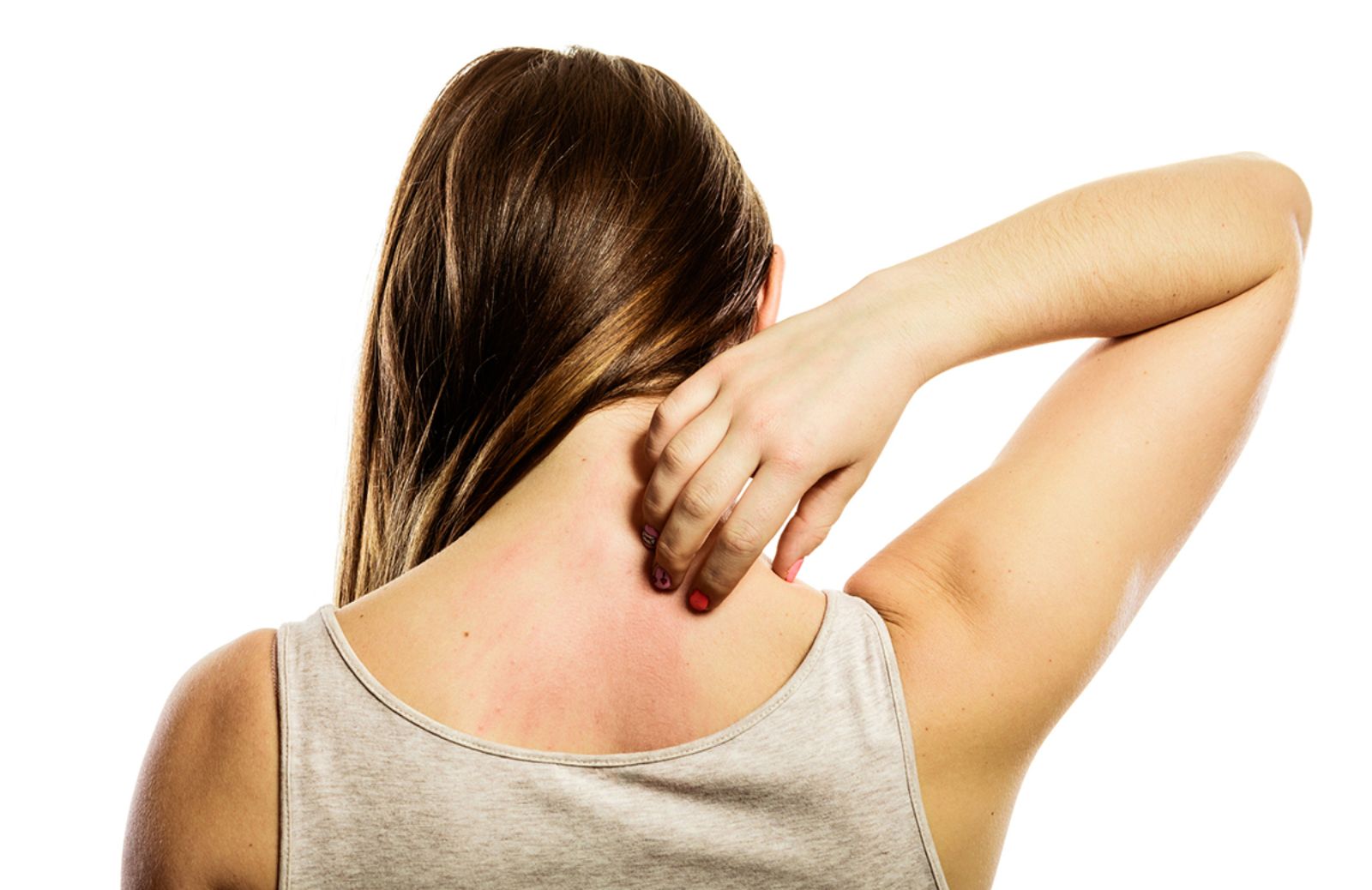 Macchie sulla pelle: tipi, cause, prevenzione e rimedi