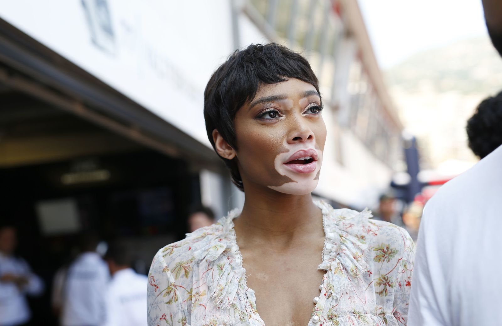 Bellezza non convenzionale: Winnie Harlow e la vitiligine