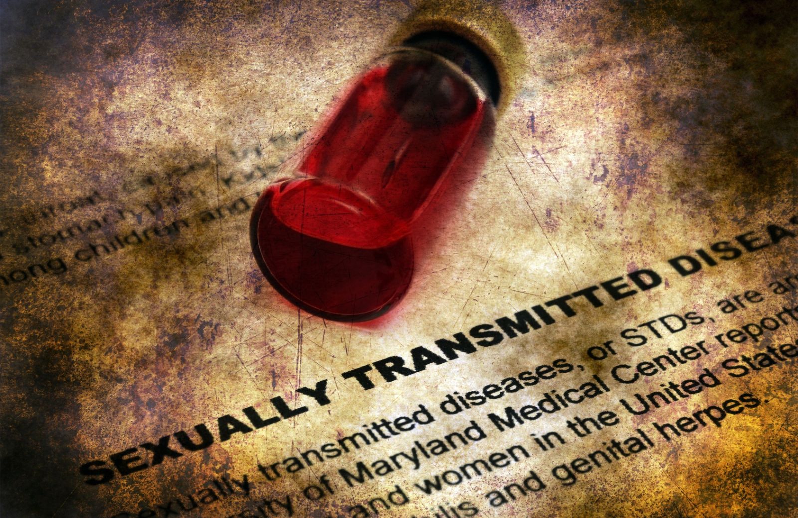 AIDS, storia di un contagio che miete ancora troppe vittime Deabyday