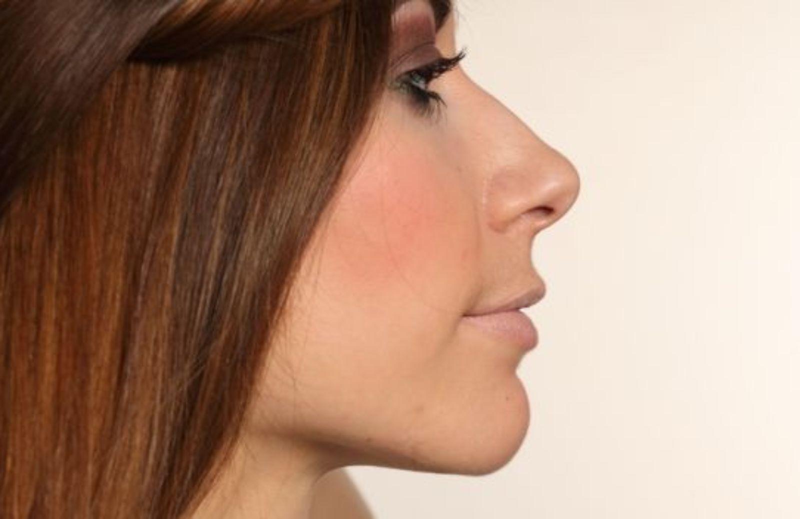 Come minimizzare i pori dilatati
