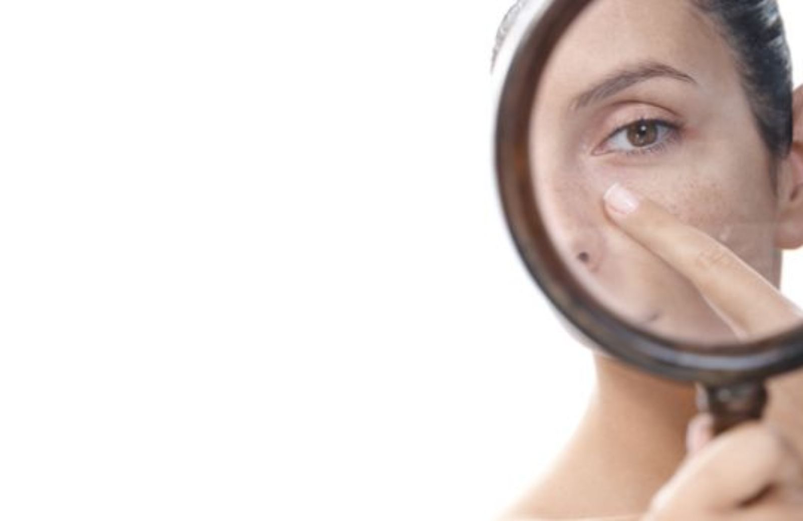 Come prevenire le macchie sulla pelle del viso