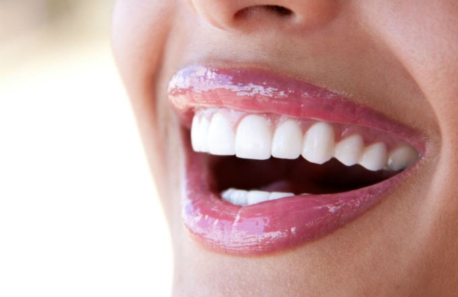 Come sbiancare i denti con un rimedio naturale