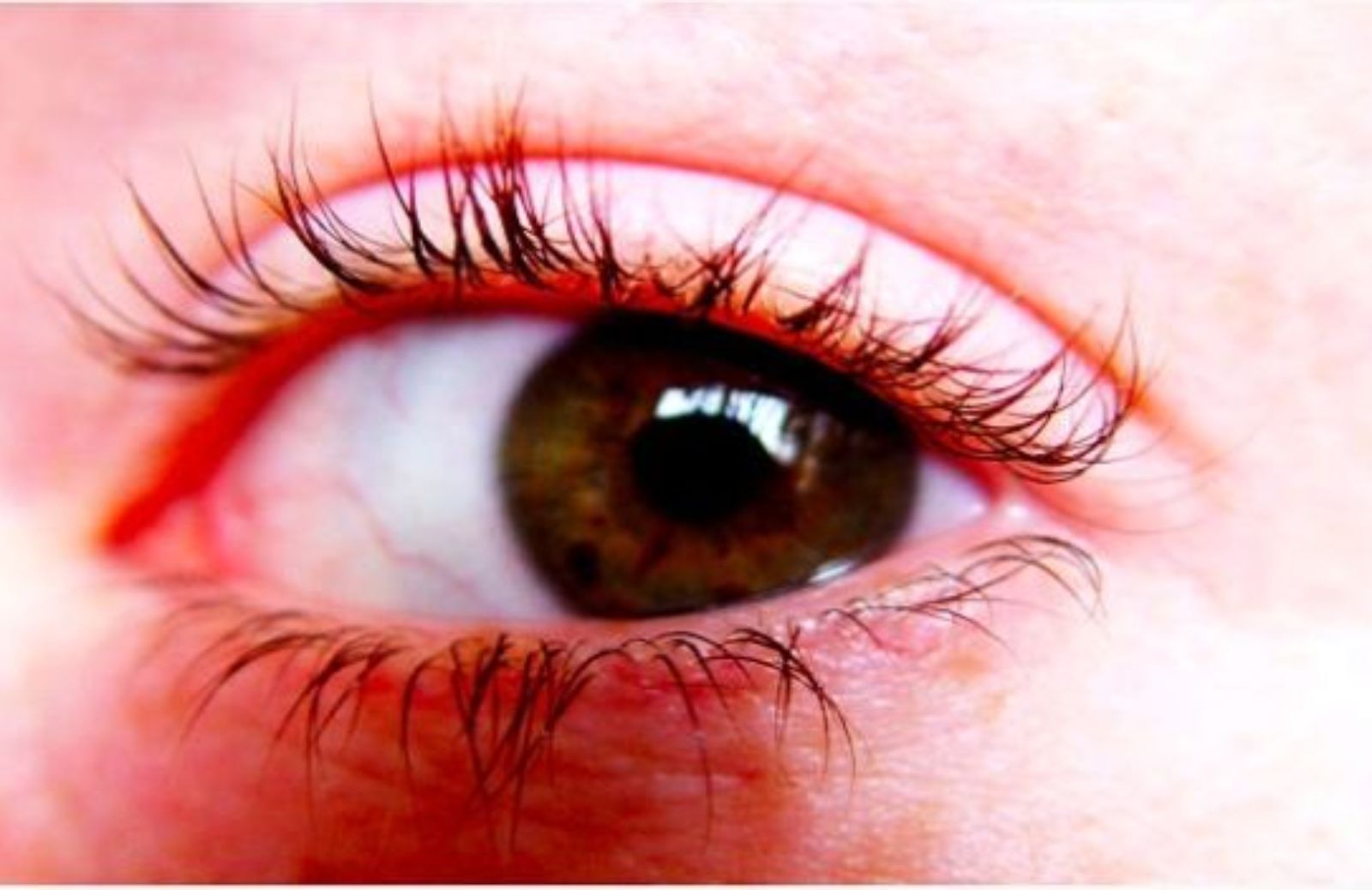 Come fare gratuitamente l'esame della vista con il mese della prevenzione
