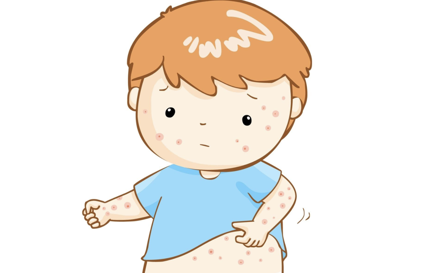 Dermatite atopica del neonato: cos'è e come trattarla