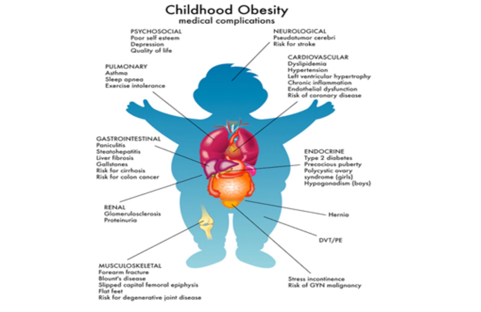 Nuove linee guida per l'obesità infantile