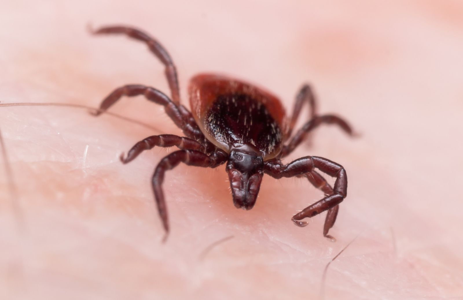 Malattia di Lyme: come riconoscerla dai sintomi