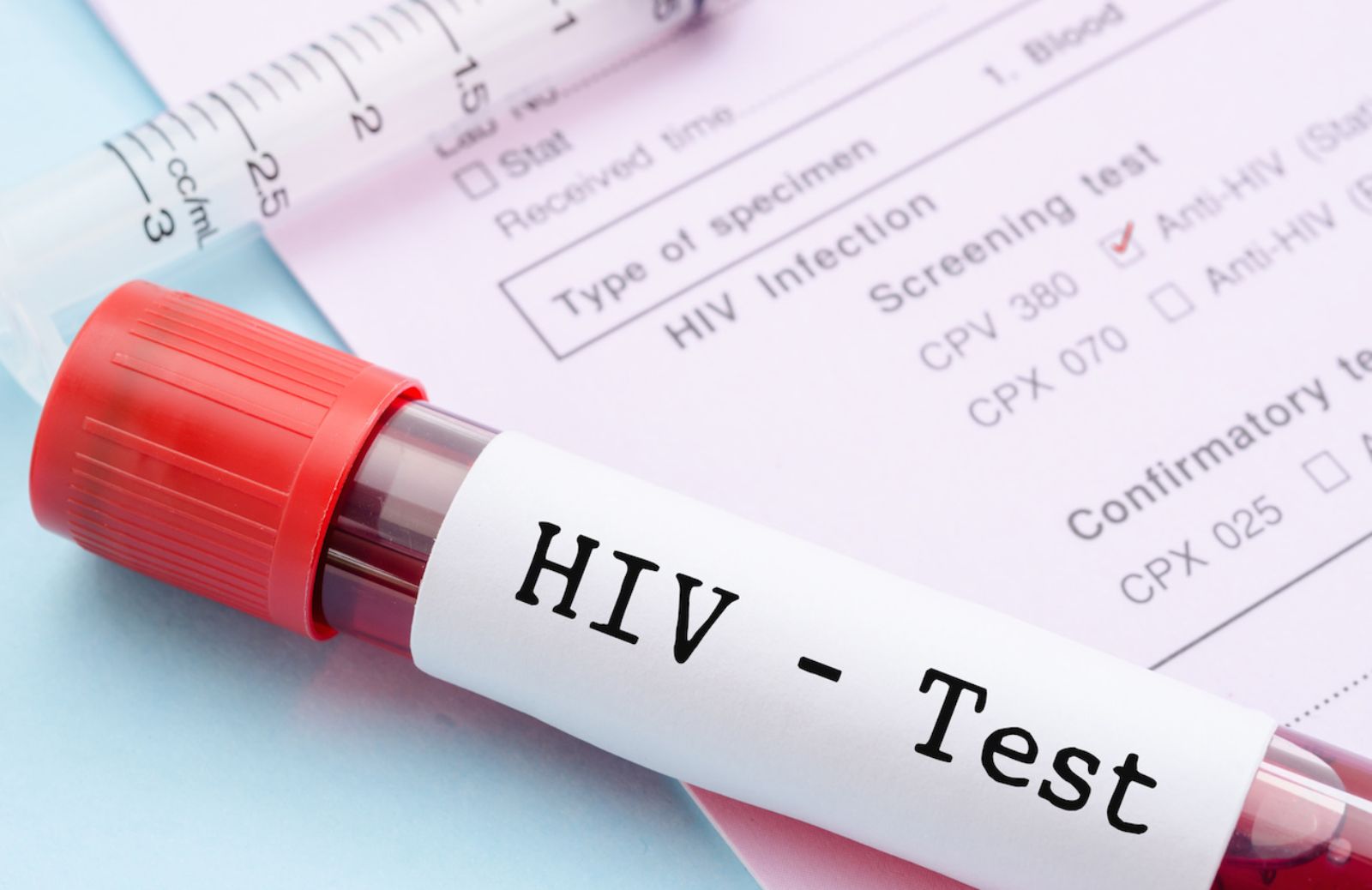 Test HIV: perché, quando e come farlo