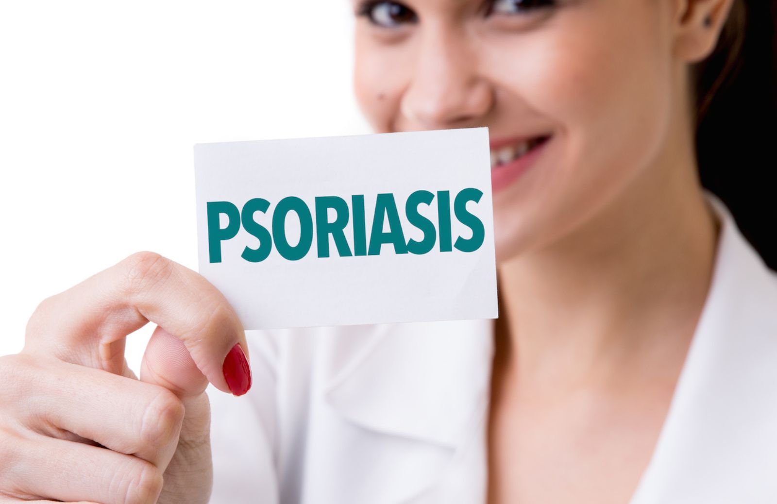Come riconoscere la psoriasi dai sintomi: le cause e le cure