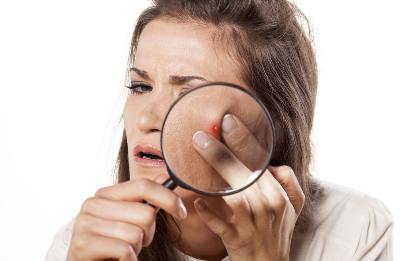 Come si cura l'acne in età adulta