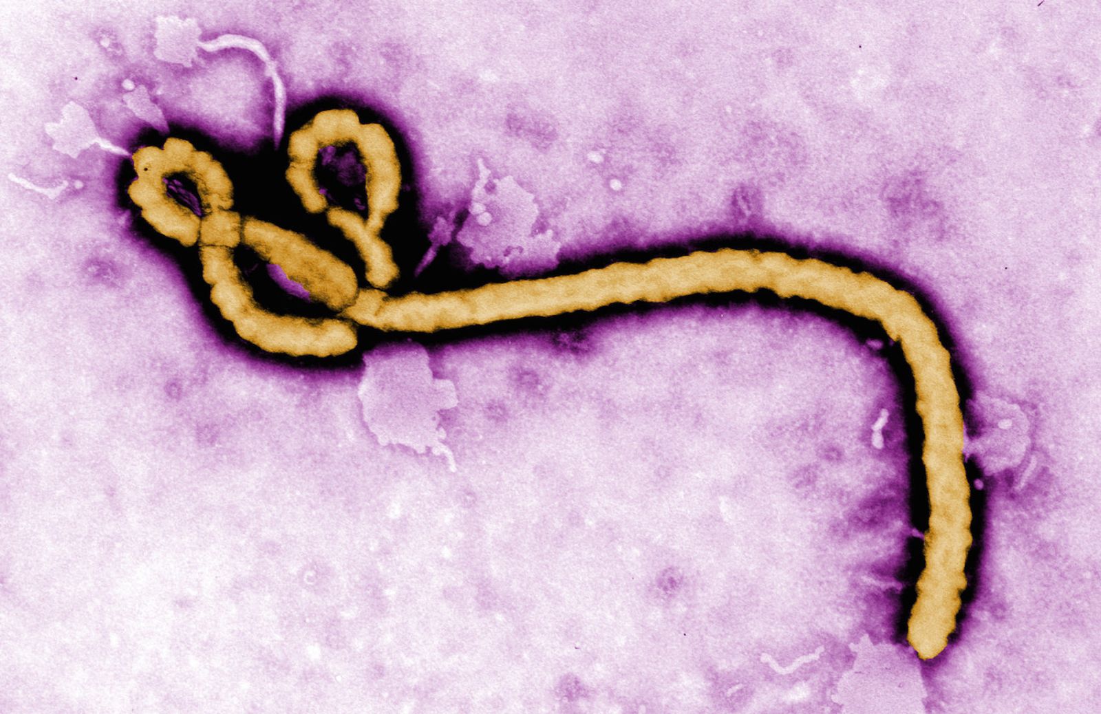 Come si trasmette il virus Ebola e qual è il rischio di contagio