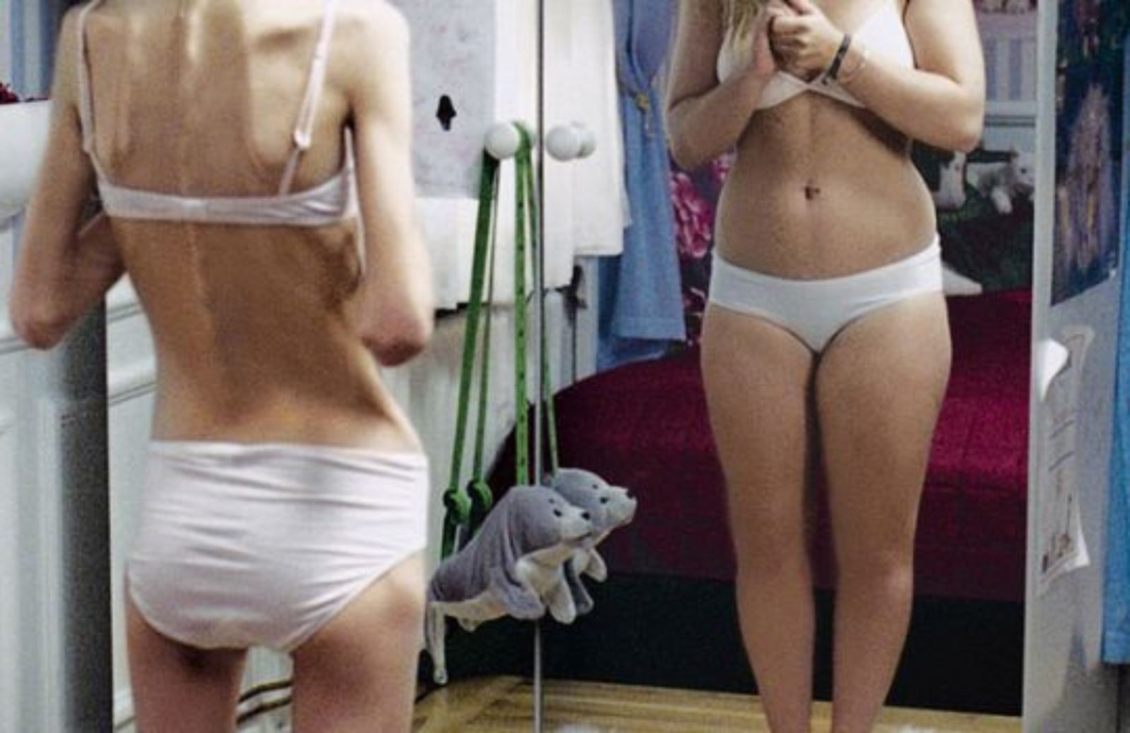 Anoressia: i problemi dell'anima e il bisogno d'ascolto