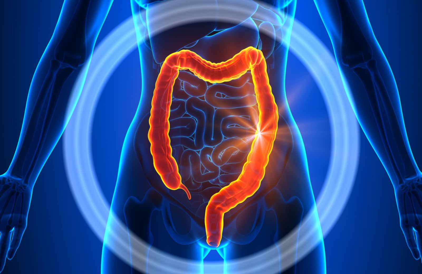 Obesità e cancro del colon retto: il legame è in un ormone?