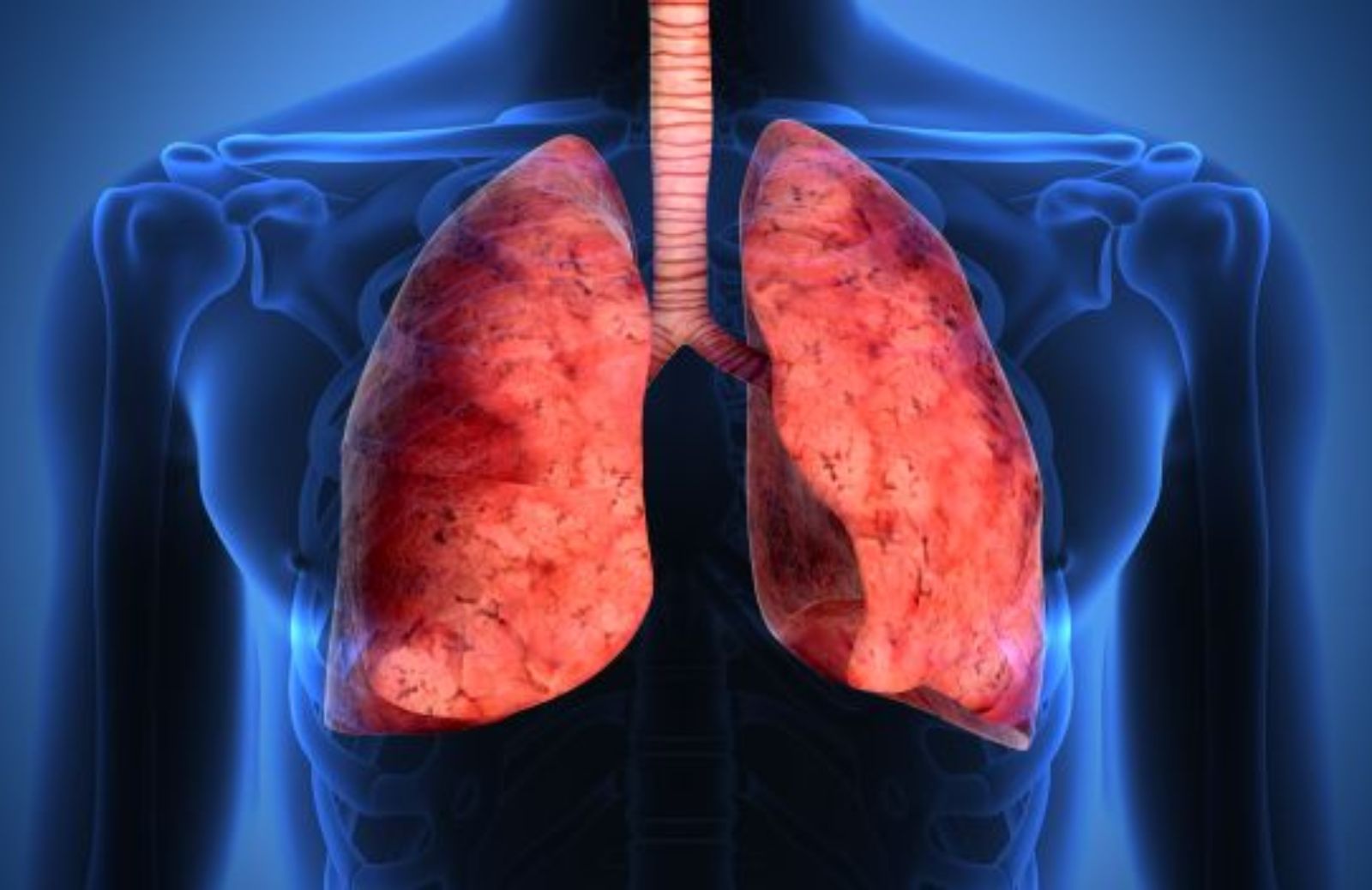 Tumore al polmone e nuove speranze: farmaci biologici e immunoterapia