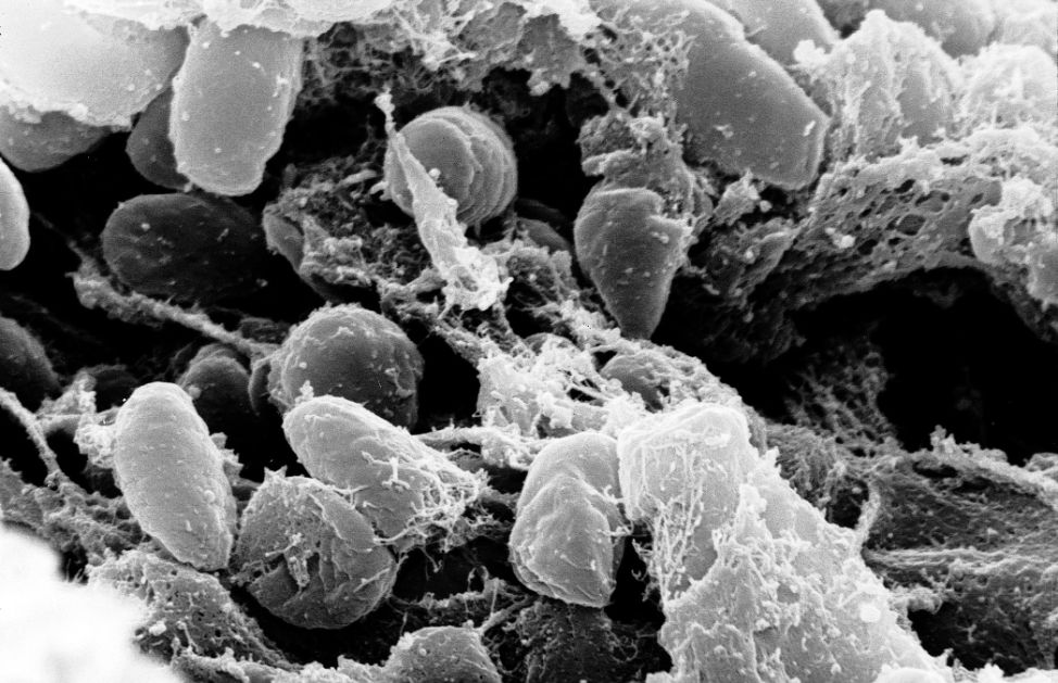 Un’epidemia di peste Bubbonica che, originatasi in Asia centrale settentrionale, dilagò in Europa dal 1347 con effetti devastanti. Il tasso di letalità fu circa del 60% e si diffuse soprattutto nei quartieri più sovrappopolati delle città, dove gli abitanti, spesso debilitati dalla malnutrizione, vivevano in condizioni igieniche precarie. In realtà l'epidemia della peste non fu causata da un virus, ma da un batterio: lo Yersinia pestis, che viaggiava seguendo le rotte commerciali continentali più frequentate, uccidendo un terzo della popolazione europea dell’epoca (tra i venti e i venticinque milioni di persone). Dello stupore angosciato dei superstiti resta testimonianza in molti scritti a cominciare dal Decamerone di Giovanni Boccaccio che descrive Firenze come un sepolcro.