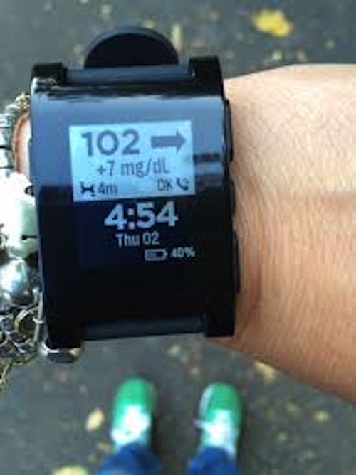 smartwatch-diabete